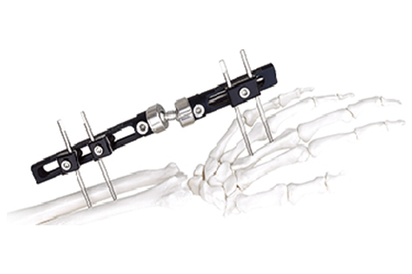 腕关节支架（单针型）