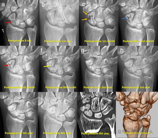 1749694388397480.jpg 1749694383526.jpg