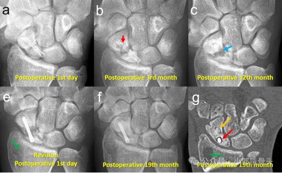 1749694410796430.jpg 1749694407245.jpg