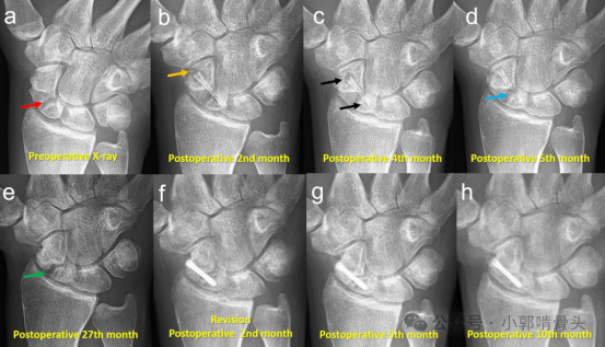 1749694429913048.jpg 1749694425419.jpg