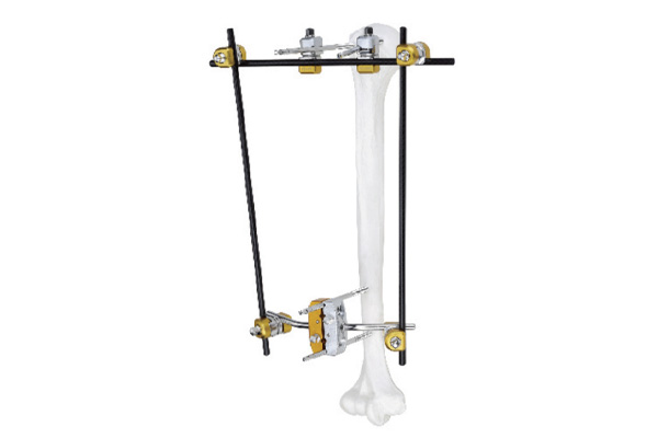 Proximal humerus fixator