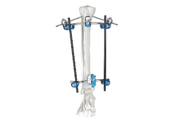 Proximal humerus fixator