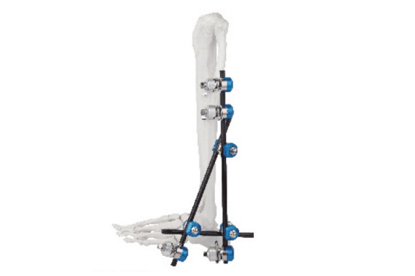 Ankle joint fixator