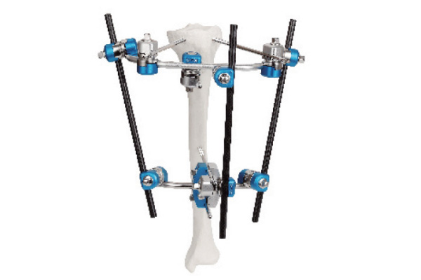 Proximal tibia external fixator