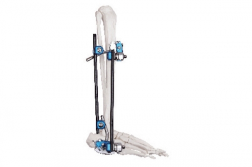 Ankle joint fixator
